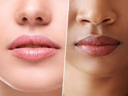Lip Pigmentation Image
